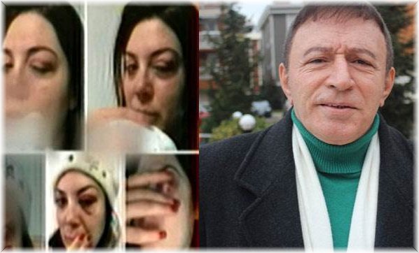 Uzaylı türkücü Mustafa Topaloğlu, eşini döverek hastanelik etti!
